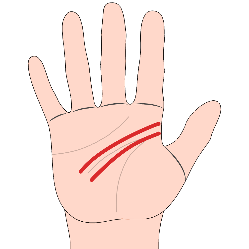 Both Slope Downwards